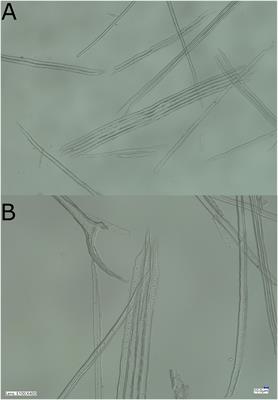 The phenotypic and genetic effects of drought-induced stress on wood specific conductivity and anatomical properties in white spruce seedlings, and relationships with growth and wood density